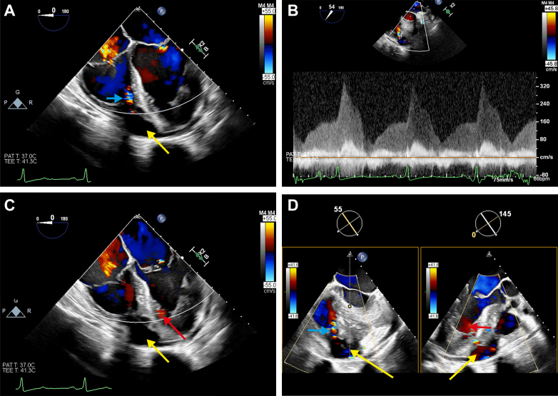 Figure 3