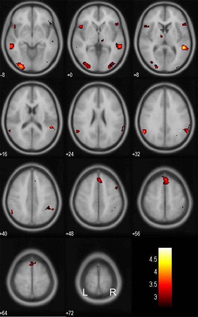 FIGURE 3