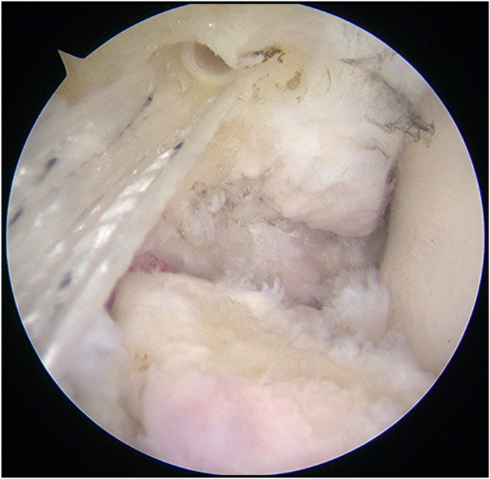 Fig. 2