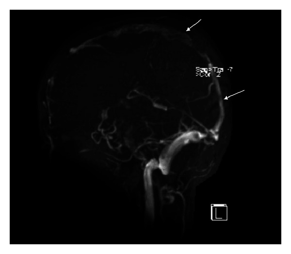 Figure 7