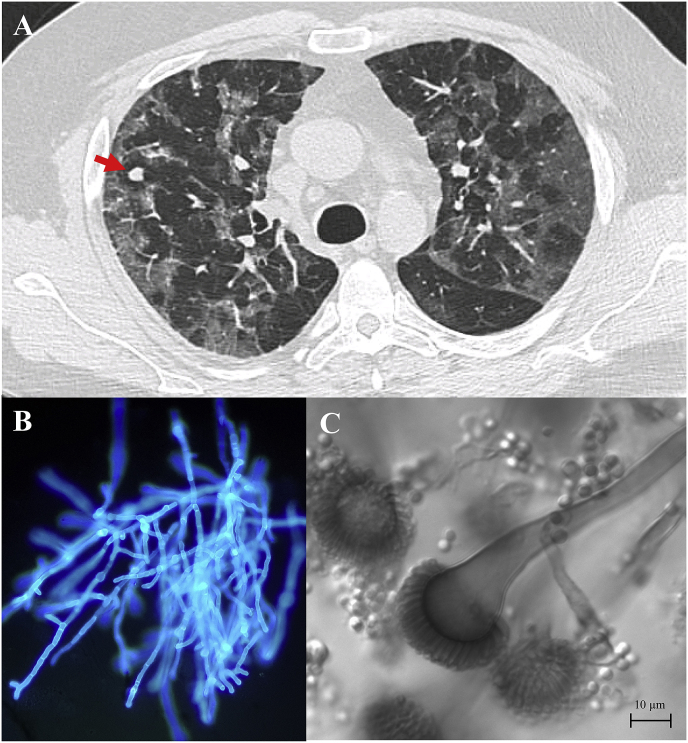 Fig. 2