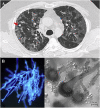 Fig. 2