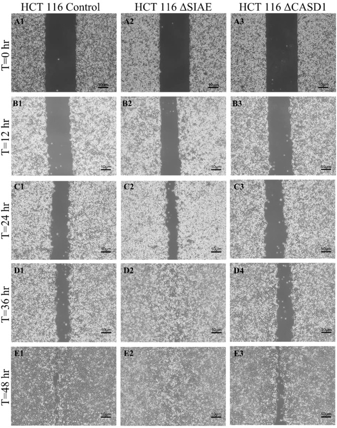 Figure 11