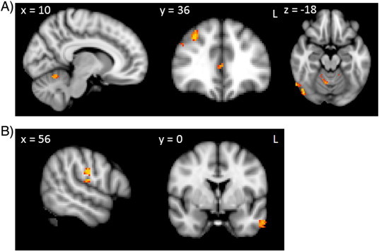 Fig. 3