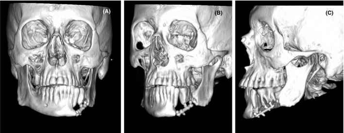 FIGURE 2