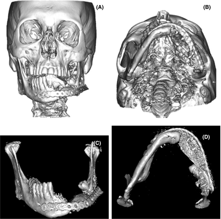 FIGURE 10