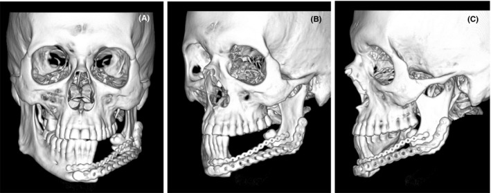 FIGURE 3