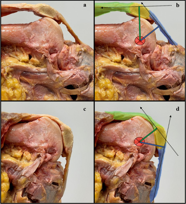 A collage of images of a human body Description automatically generated