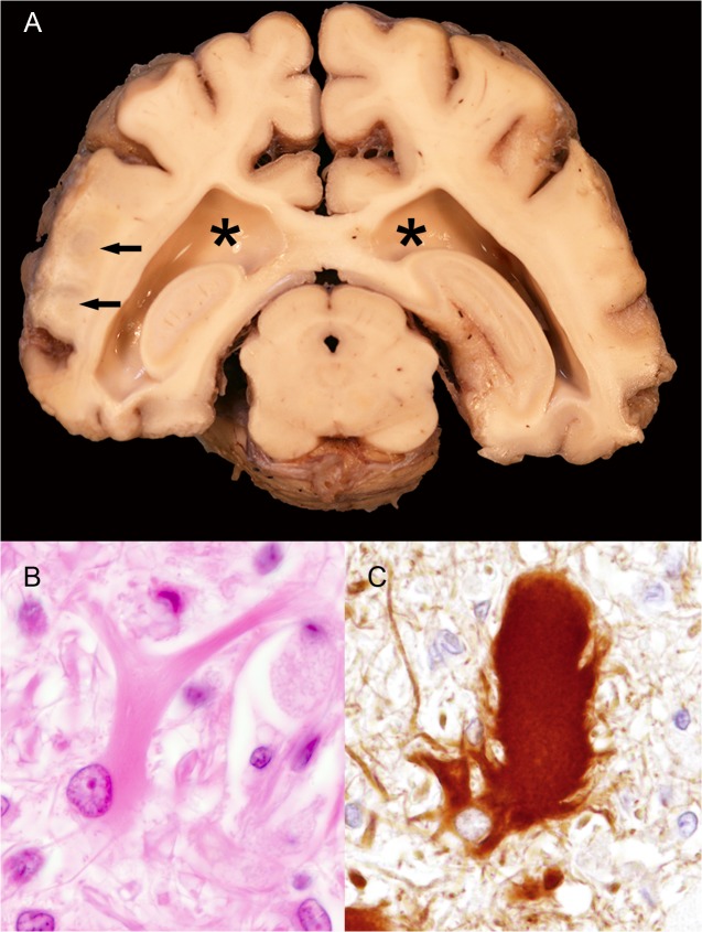 Fig 4