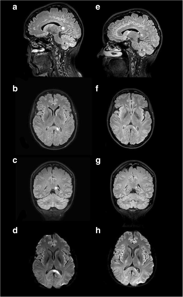 Fig. 1 (abstract P207).