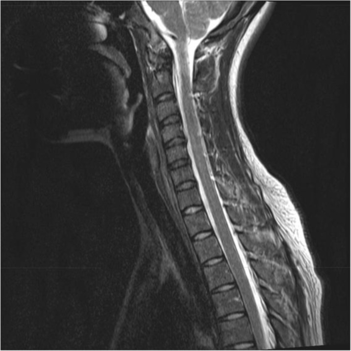 Fig. 1 (abstract P19).