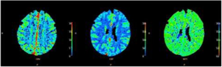 Fig. 1 (abstract P166).