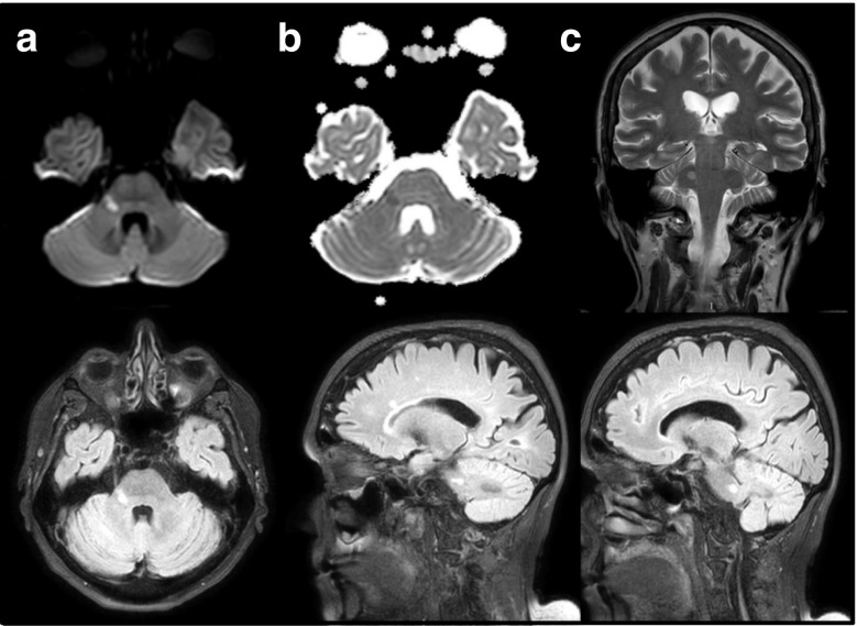 Fig. 1 (abstract P177).