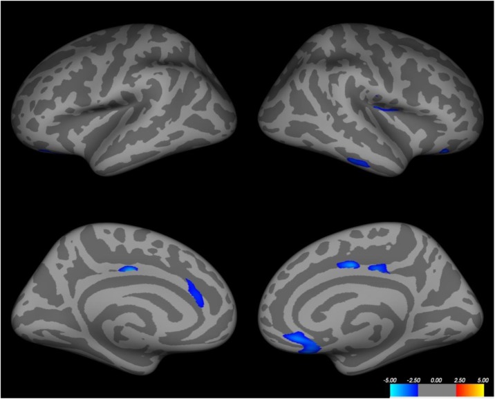 Fig. 1 (abstract O16).