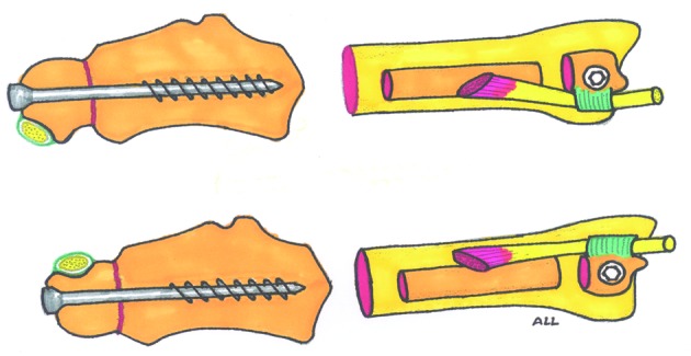 Fig. 9