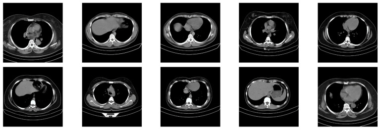 Figure 13