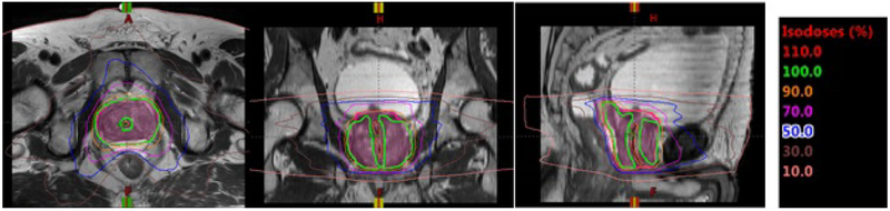 Figure 1: