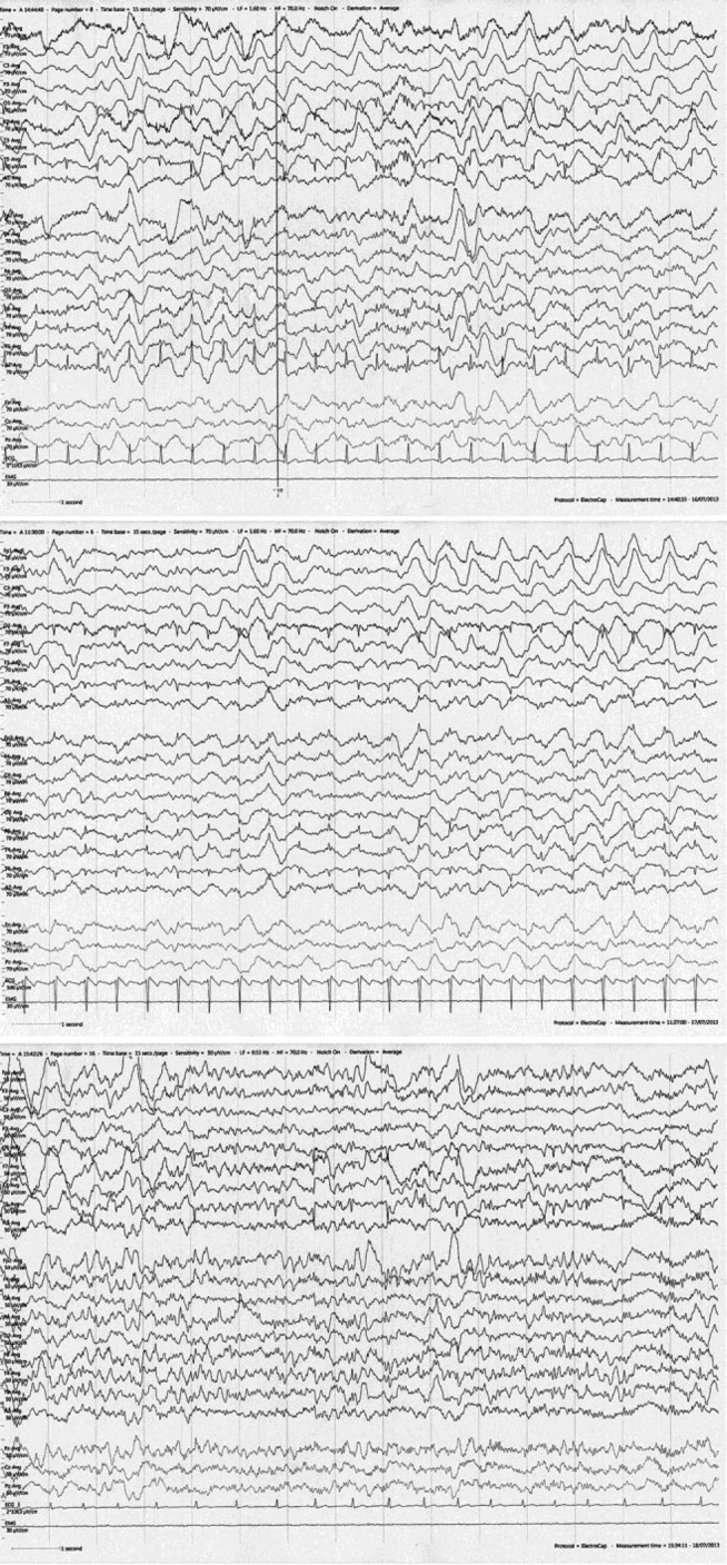 Fig. 1