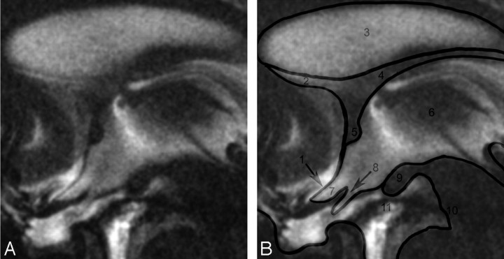 Fig 1.