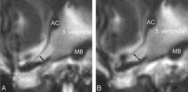 Fig 2.