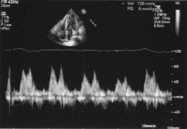 Figure 4