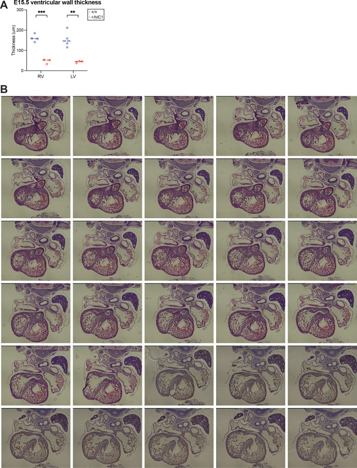 Figure 2—figure supplement 1.