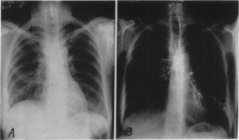 Fig. 4 (Case 1).