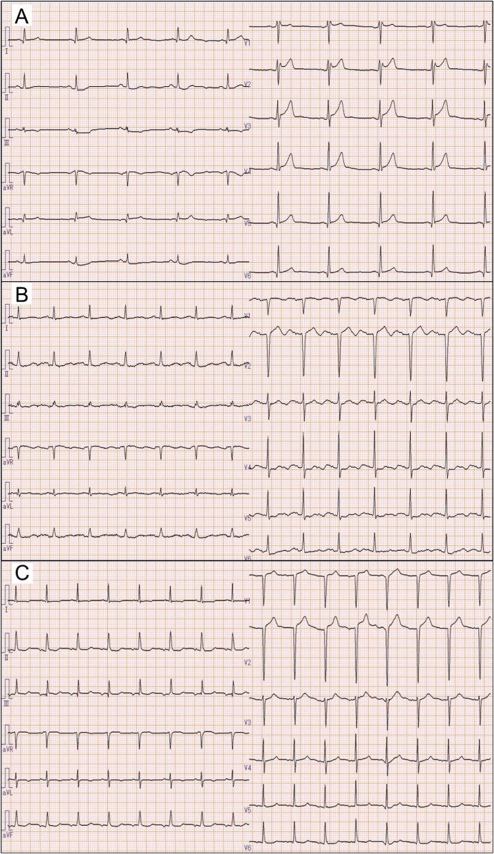 Fig. 2