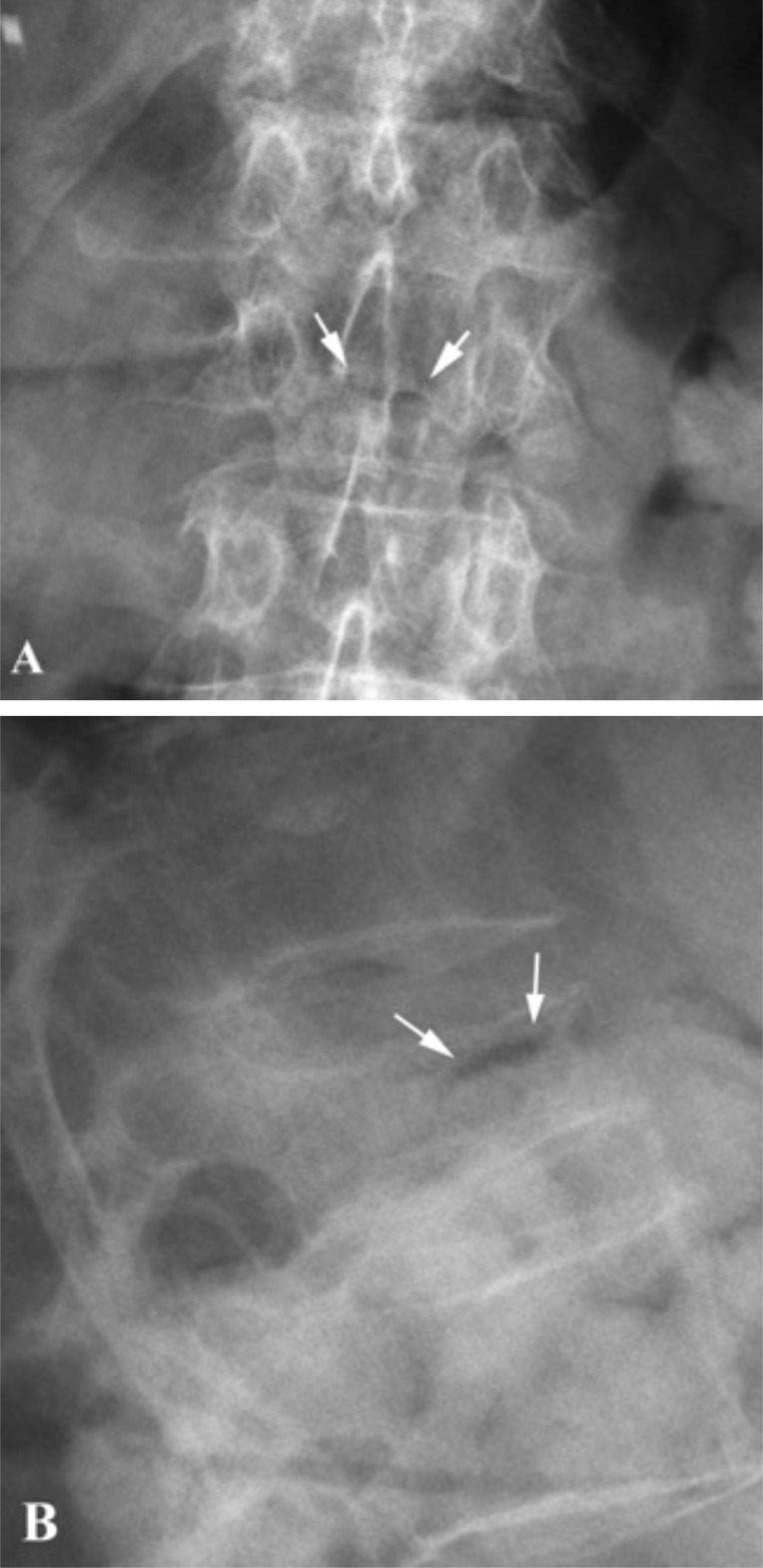 Fig. (1)