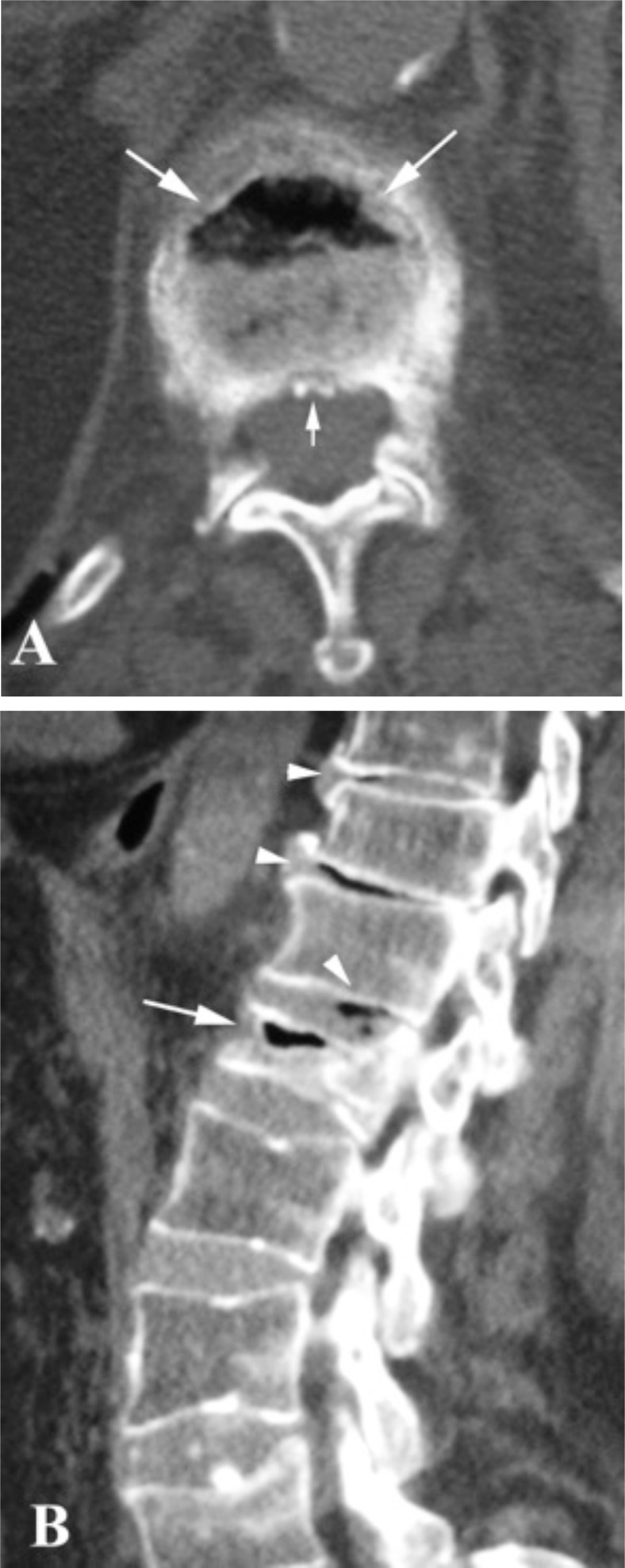 Fig. (2)