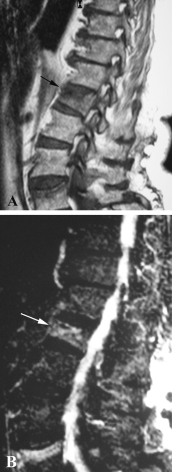 Fig. (3)