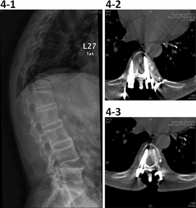 FIGURE 4