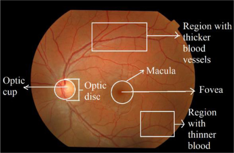 Fig 1: