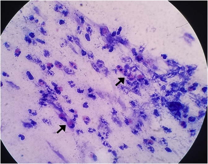 Fig. 2