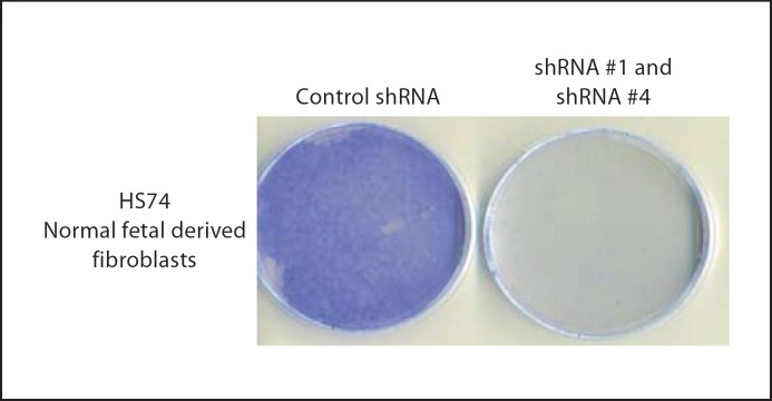 Fig. 12