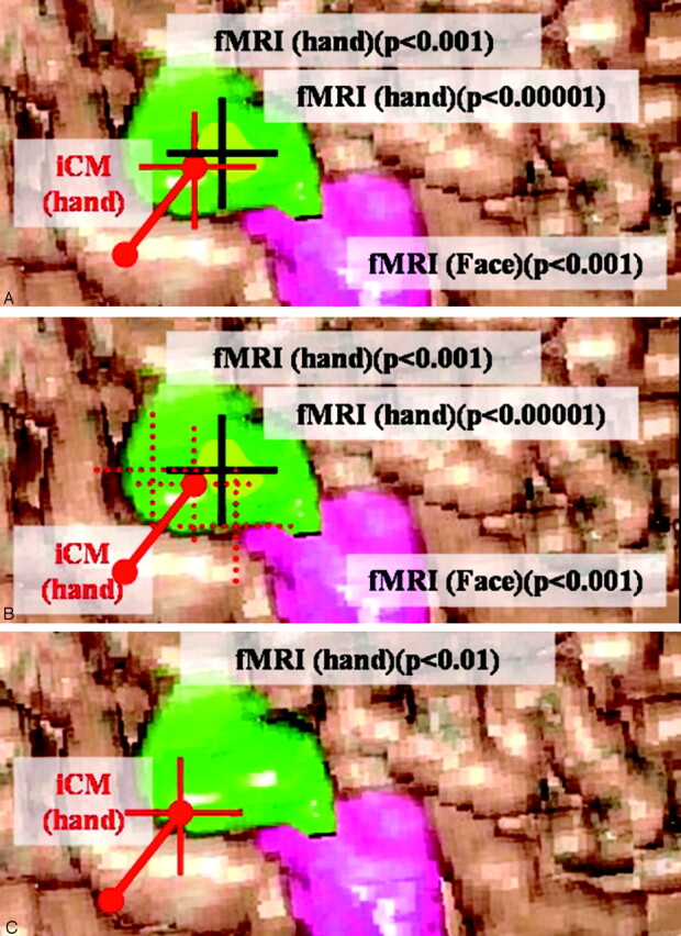 Fig 3.