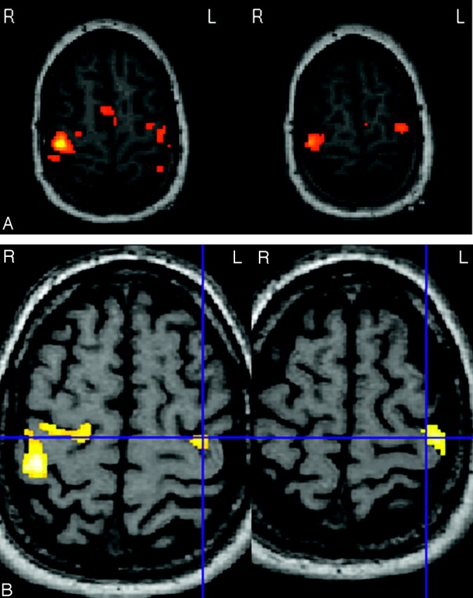 Fig 2.