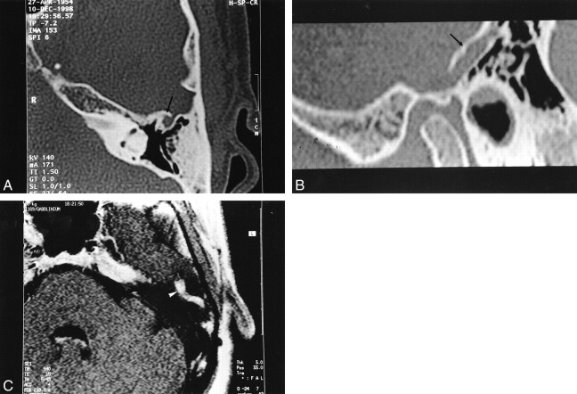 fig 6.