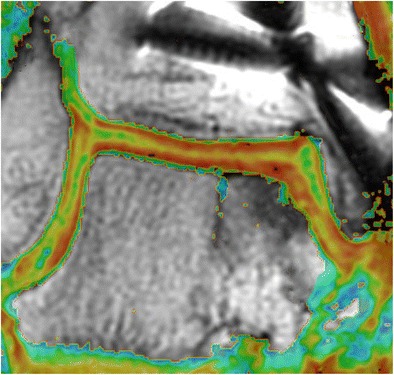 Fig. 3