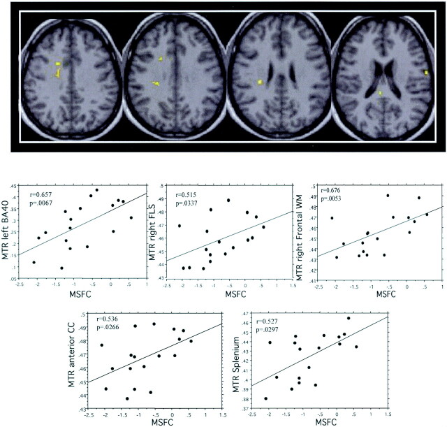 Fig 3.