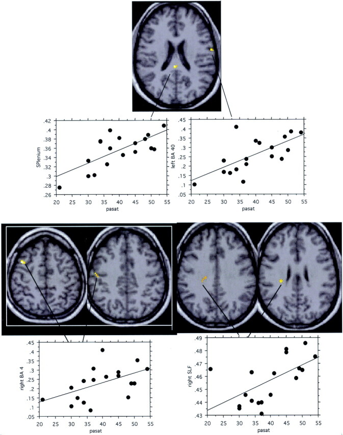 Fig 4.