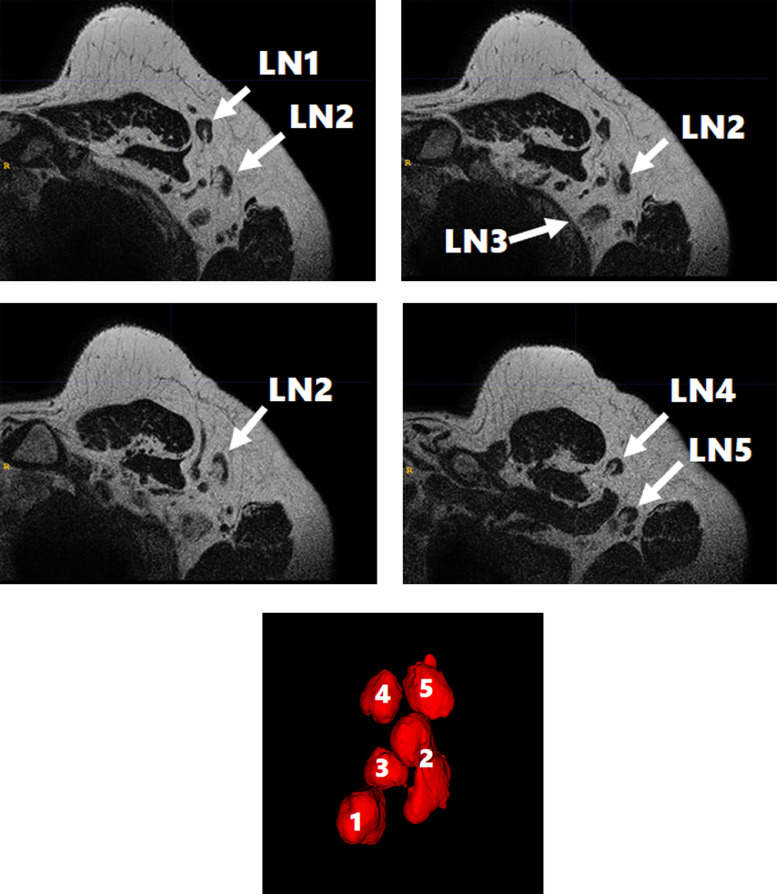 Fig 3