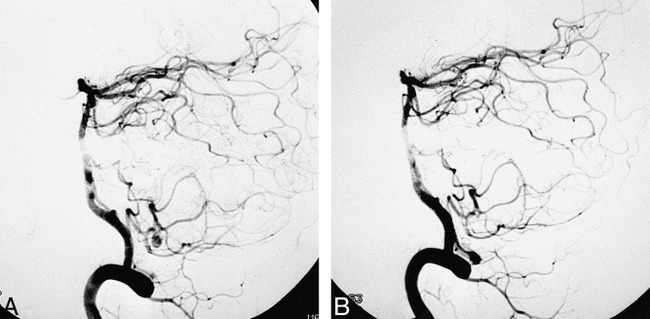 fig 2.