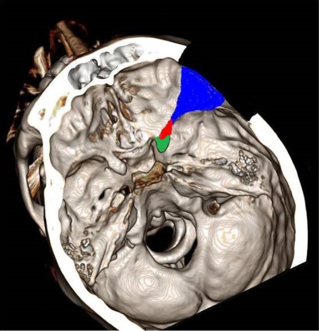 Fig. 1