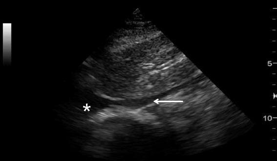 Fig. 13