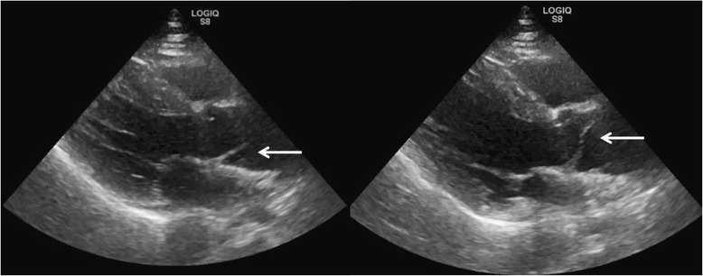 Fig. 17