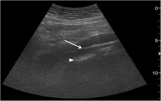 Fig. 18