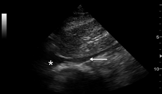 Fig. 13