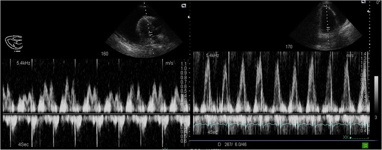 Fig. 21