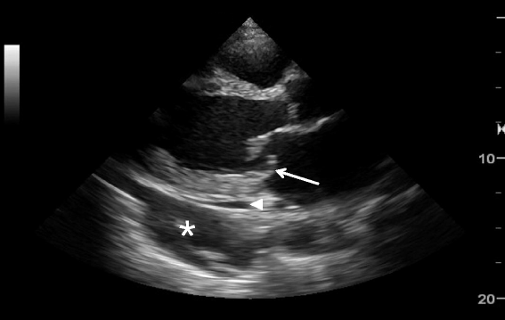Fig. 25